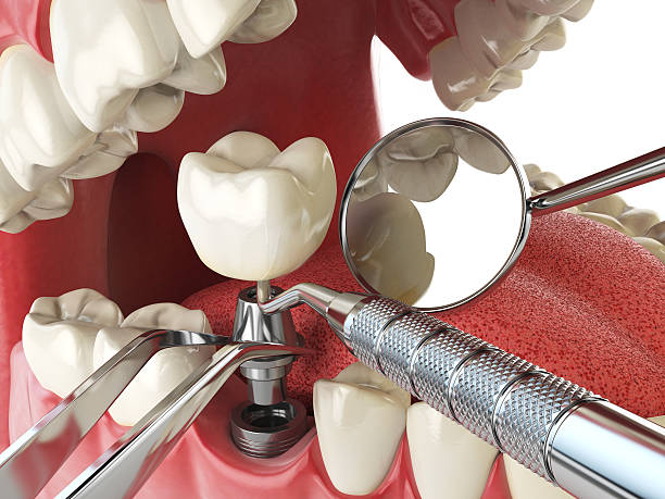 Best Emergency Dentist for Knocked-Out Tooth in Plainedge, NY
